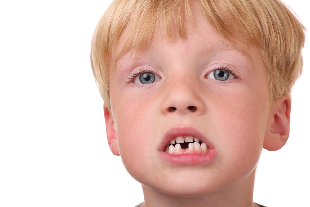 در نیامدن دندان های دائمی کودکان