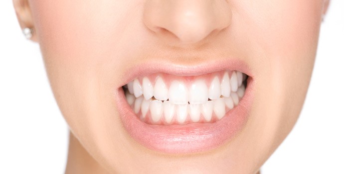 درمان دندان قروچه (براکسیسم) با ارتودنسی