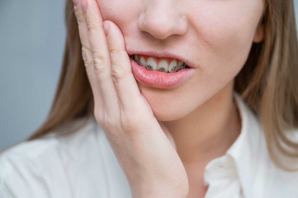 همه آنچه باید در مورد دندان‌های حساس و استفاده از بریس ها بدانید